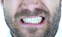 برای تضمین سلامت دندان این خوراکیها را نخورید