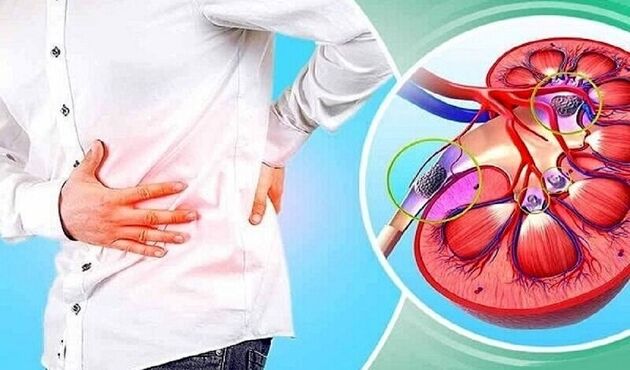 این نوشیدنی را برای فرار از سنگ کلیه نخورید! | ماءالشعیر دشمن سنگ کلیه است یا دوست آن؟